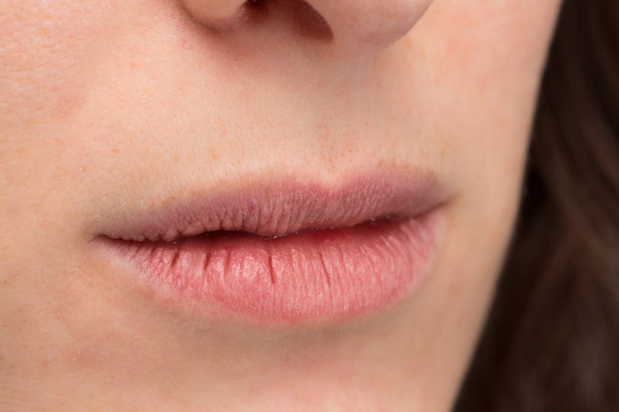 Say to Dry, Chapped Lips! – SLMD by Sandra Lee, M.D. - Dr. Pimple Popper